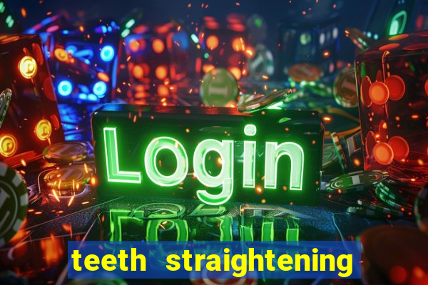 teeth straightening los altos