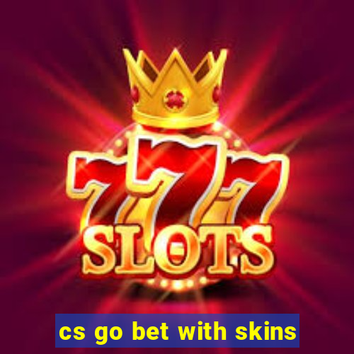 cs go bet with skins