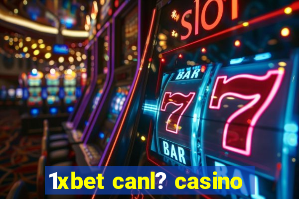 1xbet canl? casino