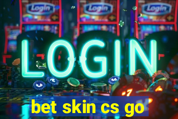 bet skin cs go