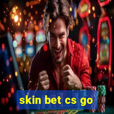 skin bet cs go