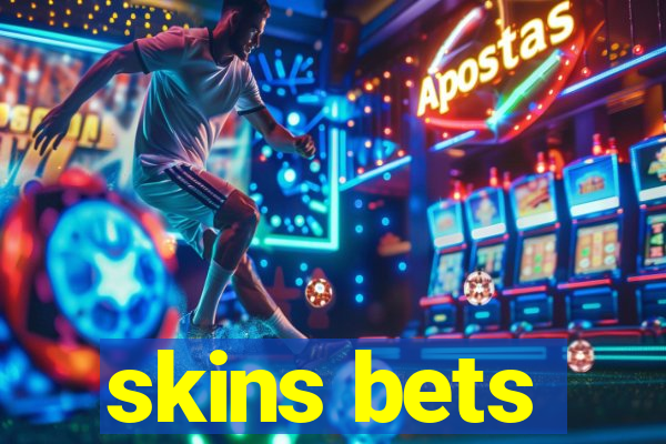 skins bets